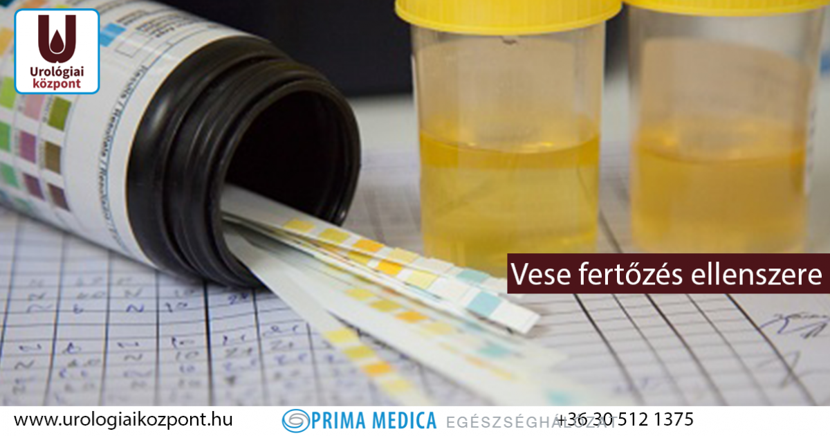 gyógyászati készítmények a diabétesz kezelésére 2