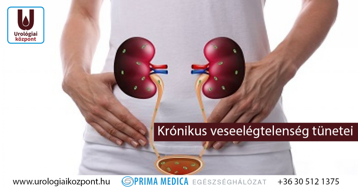 Akut veseelégtelenség tünetei és kezelése