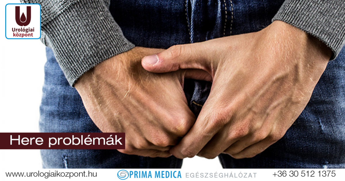 a petyhüdt pénisz oka fotó gyenge erekció