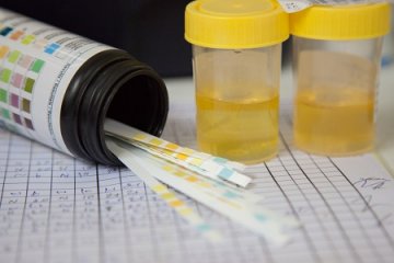 Elégségesek a házi gyógymódok vesefertőzésnél?