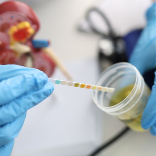 Húgyúti fertőzés - Urológiaiközpont