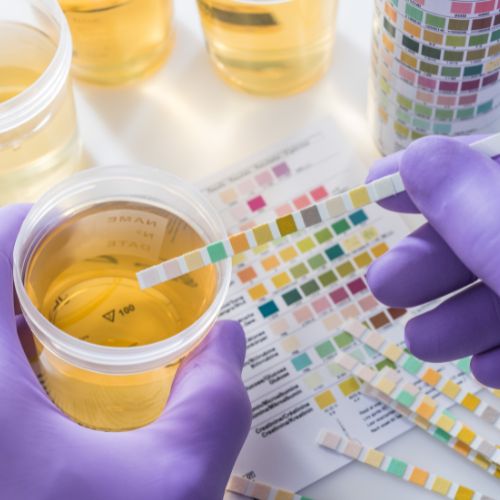 Véres vizelet - Urológiaiközpont